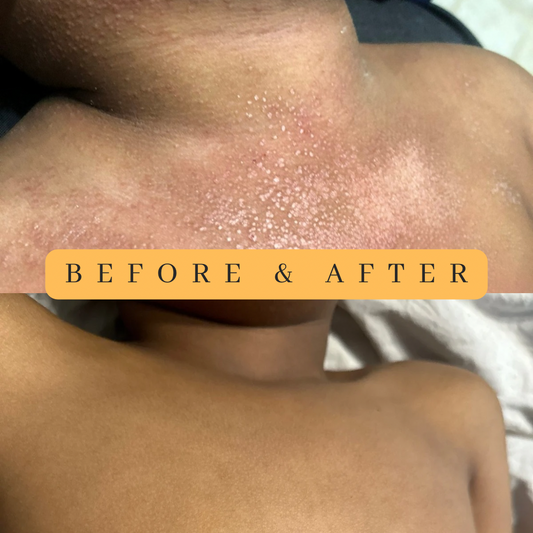 ALL NATURAL HEALING BALM